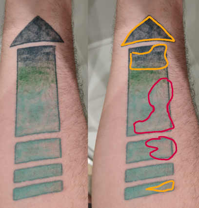 Photo of tattoo highlighting areas for ink touch-up